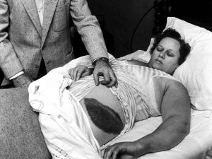 The First Person Ever Hit By A Meteorite: What Happened To Her?