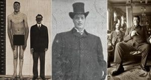 The Tragic Story Of Adam Rainer Who Born A Dwarf Grew Into A Giant